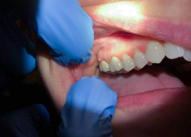 Best Emergency Broken Tooth Repair in Cohasset, MN