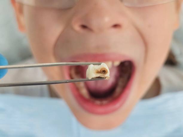 Best Pediatric Emergency Dentist in Cohasset, MN